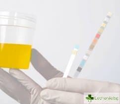 Албумин в урината: индикатор за здравословното състояние